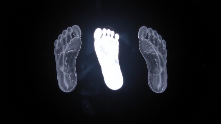 pronation types explained